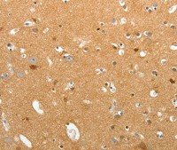 Антитела Tenascin R, кроличьи поликлональные, Thermo FS