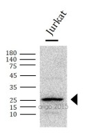 Панель антител Apoptosis Marker Antibody Duo (Bcl2, Bax), Arigobio