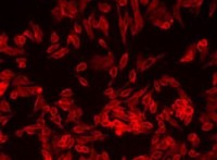 Набор для окраски плазматической мембраны Orange Fluorescence - Cytopainter, Abcam