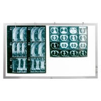 Светодиодный негатоскоп TAGLER НСД-2 (2-кадровый)