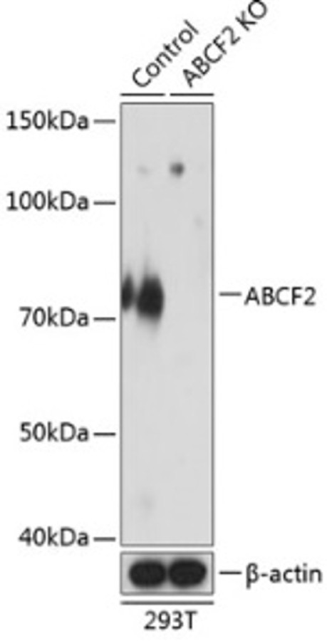 Антитела [KO Validated] ABCF2 кроличьи, поликлональные, ABclonal