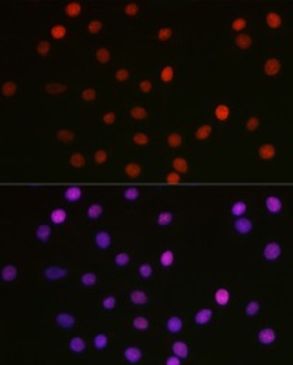 Антитела [KO Validated] Acetyl-HMGB1-K29 кроличьи, поликлональные, ABclonal