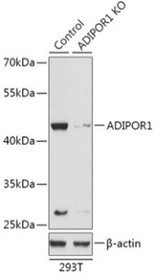 Антитела [KO Validated] ADIPOR1 кроличьи, поликлональные, ABclonal