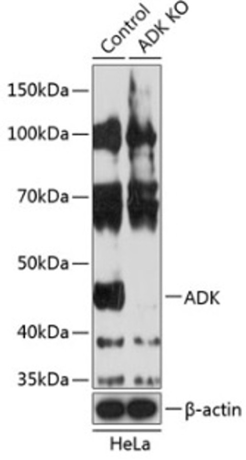 Антитела [KO Validated] ADK кроличьи, поликлональные, ABclonal