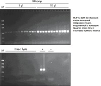 Набор для выделения ДНК из биологических образцов малого объёма QIAamp DNA Miсro Kit, Qiagen
