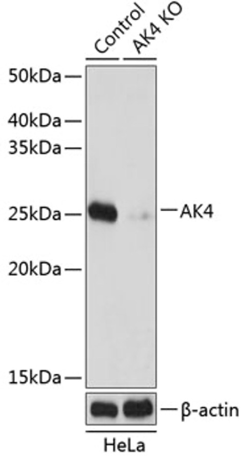 Антитела [KO Validated] AK4 кроличьи, поликлональные, ABclonal