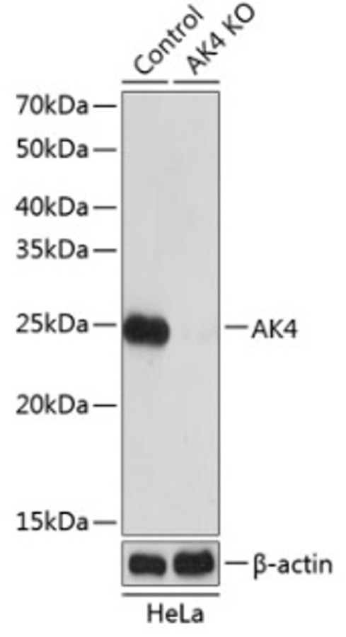 Антитела [KO Validated] AK4 кроличьи, поликлональные, ABclonal (DM_A19854.20ul)