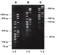 Агароза, низкий EEO, LM Sieve, легкоплавкая, Genetic Quality Tested, diaGene