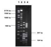 Агароза, низкий EEO, MS-12, Molecular Screening, повышенная четкость разделения фрагментов 50-1500 п.н., diaGene
