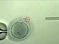 Система лазерной диссекции Zilos-tk, ИК-лазер, без микроскопа, Hamilton Thorne