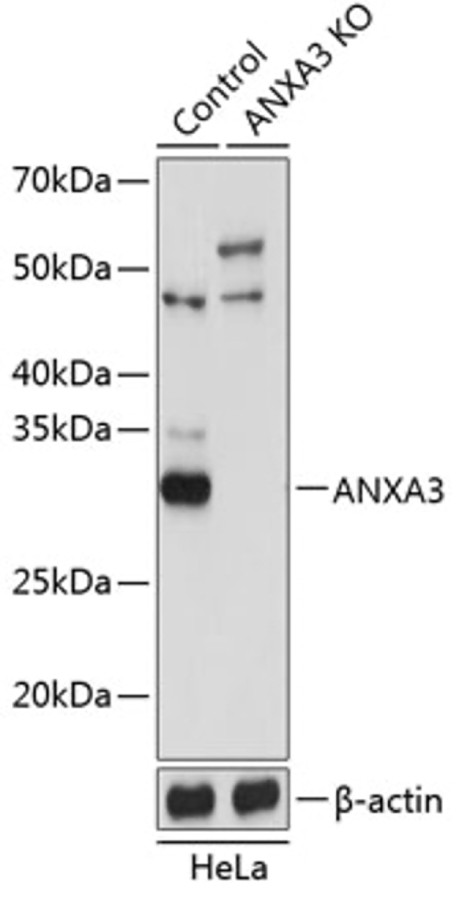 Антитела [KO Validated] ANXA3 кроличьи, поликлональные, A19862, ABclonal