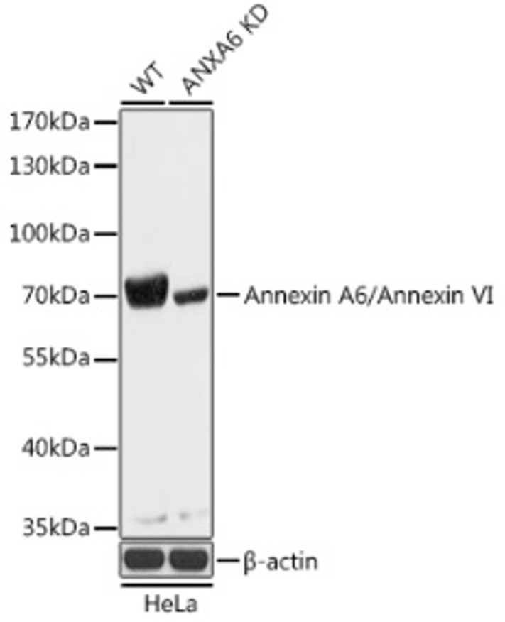 Антитела [KO Validated] ANXA6 кроличьи, поликлональные, ABclonal