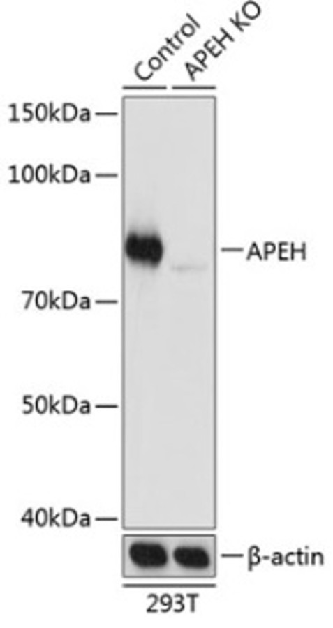 Антитела [KO Validated] APEH кроличьи, поликлональные, A19912, ABclonal