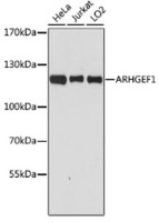 Антитела [KO Validated] ARHGEF1 кроличьи, поликлональные, ABclonal