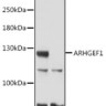 Антитела [KO Validated] ARHGEF1 кроличьи, поликлональные, ABclonal