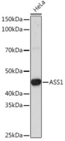 Антитела [KO Validated] ASS1 кроличьи, поликлональные, ABclonal
