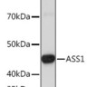 Антитела [KO Validated] ASS1 кроличьи, поликлональные, ABclonal