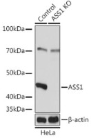 Антитела [KO Validated] ASS1 кроличьи, поликлональные, ABclonal