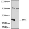 Антитела [KO Validated] ASS1 кроличьи, поликлональные, ABclonal