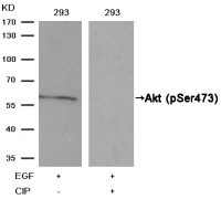 Антитела anti-Akt phospho (Ser473) antibody, кроличьи поликлональные, Arigobio