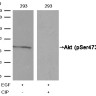 Антитела anti-Akt phospho (Ser473) antibody, кроличьи поликлональные, Arigobio