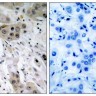Антитела anti-Akt phospho (Ser473) antibody, кроличьи поликлональные, Arigobio