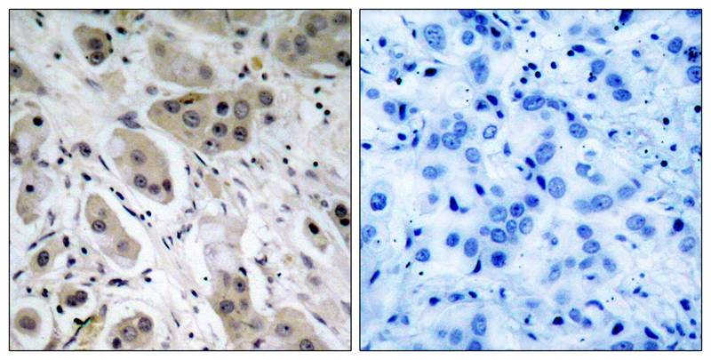Антитела anti-Akt phospho (Ser473) antibody, кроличьи поликлональные, Arigobio