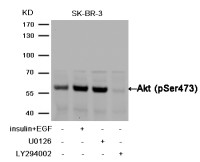 Антитела anti-Akt phospho (Ser473) antibody, кроличьи поликлональные, Arigobio