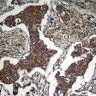 Антитела anti-Akt phospho (Ser473) antibody, кроличьи поликлональные, Arigobio