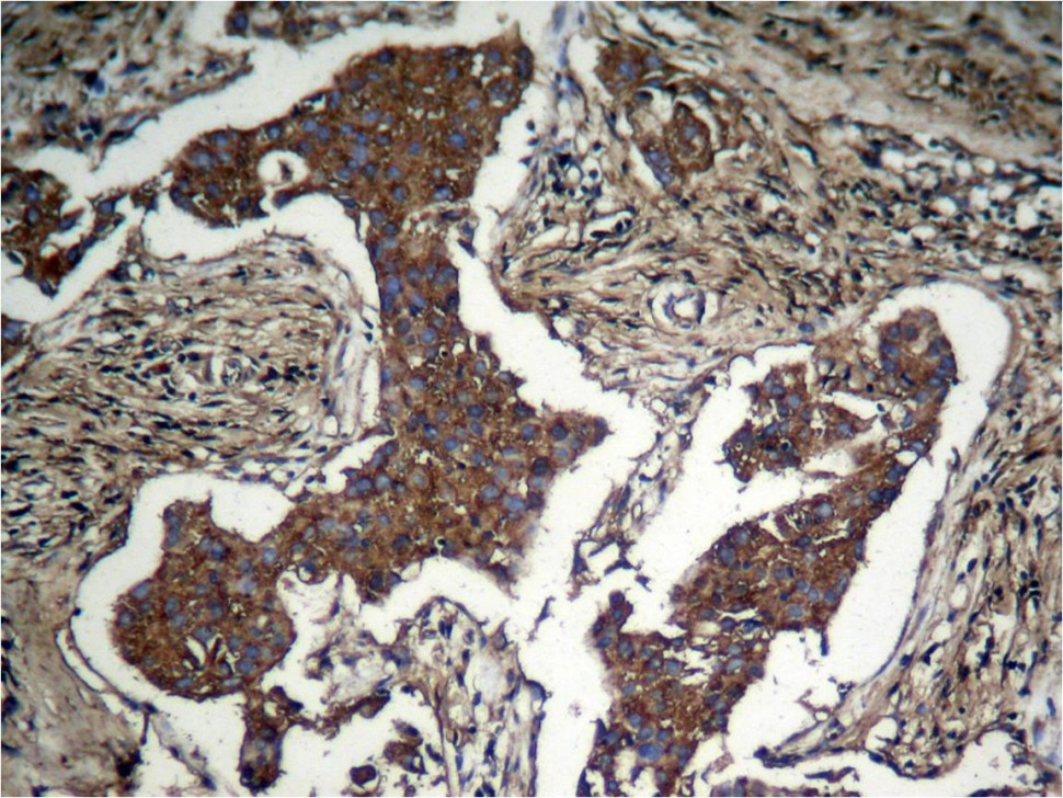 Антитела anti-Akt phospho (Ser473) antibody, кроличьи поликлональные, Arigobio