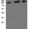 Антитела Amyloid Precursor Protein Antibody, кроличьи, поликлональные, Arigobio