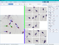 Спермоанализатор на базе ПО для компьютерного анализа эякулята, Аргус-CASA, АргусСофт