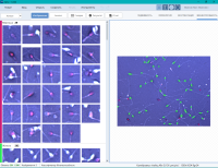 Спермоанализатор на базе ПО для компьютерного анализа эякулята, Аргус-CASA, АргусСофт